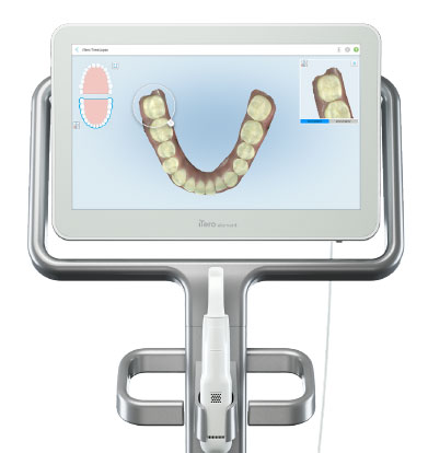 iTero Scanner